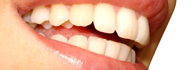 Чувствительные зубы? Как укрепить эмаль? Как уменьшить боль сверхчувствительных зубов?