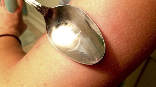 Как можно мгновенно избавиться от зудящего укуса комара используя ложку